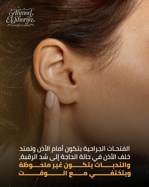 جرح عملية شد الوجه